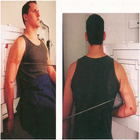 Upper Limb Radiographic Positioning ícone