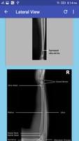 Upper Limb Radiographic Positioning imagem de tela 3