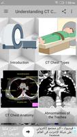 CT Chest Interpretation پوسٹر