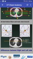 CT Chest Interpretation imagem de tela 2