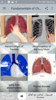 Chest X-Ray Interpretation تصوير الشاشة 1