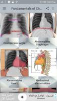 Chest X-Ray Interpretation capture d'écran 2