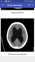 CT Brain Screenshot 3