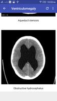 CT Brain 截圖 3