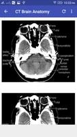 CT Brain تصوير الشاشة 1
