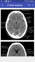 CT Brain Screenshot 2