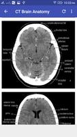 CT Brain اسکرین شاٹ 2