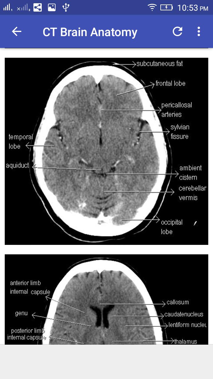 Ct Scan Diagram