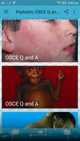 Pediatrics OSCE Q and A الملصق