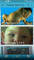 Pediatrics OSCE Q and A تصوير الشاشة 1