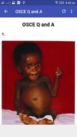 Pediatrics OSCE Q and A تصوير الشاشة 2