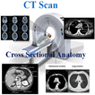 ”Scan Cross Sectional Anatomy