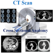 CT Scan Cross Sectional Anatomy