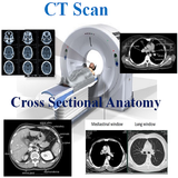 CT Scan Cross Sectional Anatomy Zeichen