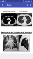 CT Scan Cross Sectional Anatomy Screenshot 3
