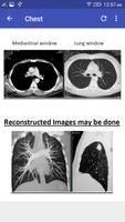 CT Scan Cross Sectional Anatomy syot layar 3