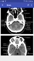 CT Scan Cross Sectional Anatomy Plakat