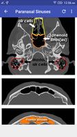 CT Scan Cross Sectional Anatomy capture d'écran 1