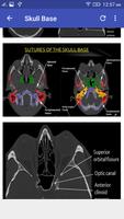 CT Scan Cross Sectional Anatomy Screenshot 2