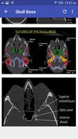 CT Scan Cross Sectional Anatomy capture d'écran 2