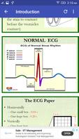 A to Z ECG Interpretation স্ক্রিনশট 1