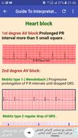 ECG Interpretation Made Easy capture d'écran 3