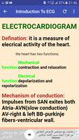 ECG Interpretation Made Easy ảnh chụp màn hình 1