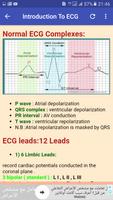 ECG Interpretation Made Easy capture d'écran 2