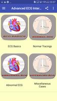 Advanced ECG Interpretation ảnh chụp màn hình 1