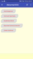 Advanced ECG Interpretation ảnh chụp màn hình 2