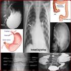 X Ray Chest Urinary Bone & GIT icône