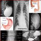 X Ray Chest Urinary Bone & GIT biểu tượng