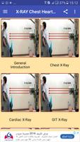 X Ray Chest Urinary Bone & GIT ảnh chụp màn hình 1