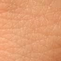 Skin Infections & Cures