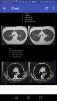 CT Scan Anatomy ATLAS imagem de tela 3