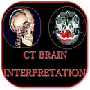 CT Brain Basic Interpretation aplikacja