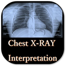 Chest X-Ray Interpretation - A basic guid aplikacja