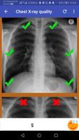 Chest X-Ray Interpretation 截图 2