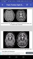 Magnetic Resonance Imaging (MRI) Sequences screenshot 1