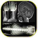 Musculoskeletal X-Rays - All in 1 aplikacja