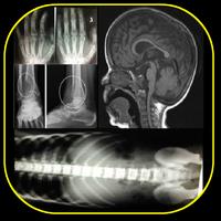Musculoskeletal X-Rays - All in 1 تصوير الشاشة 1