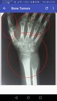 Musculoskeletal X-Rays - All in 1 تصوير الشاشة 3