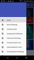 Pathology Mnemonics poster