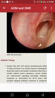 Ear Infection captura de pantalla 2