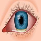 Common Eye Diseases icône
