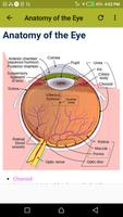 Common Eye Diseases capture d'écran 1
