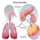 All respiratory disorder APK