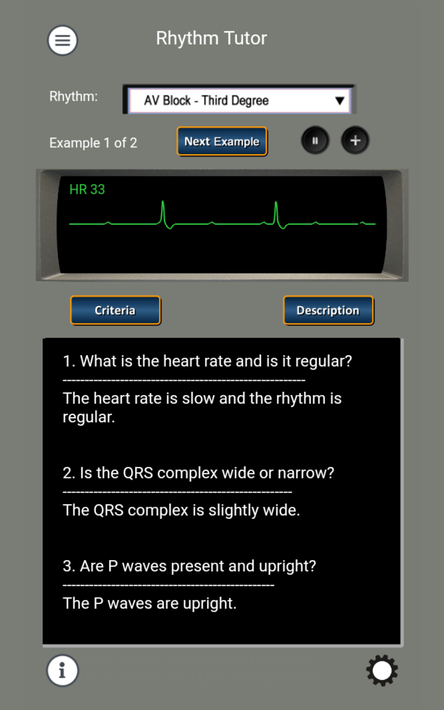 ECG Rhythms and ACLS Cases screenshot 10