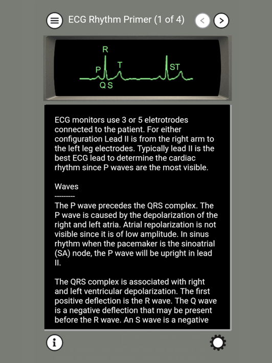 ECG Rhythms and ACLS Cases screenshot 9