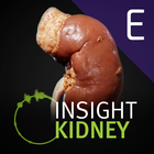 ikon INSIGHT KIDNEY Enterprise